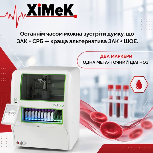 ШОЕ списувати зарано.